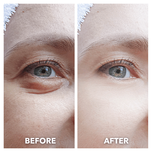 LumiLift™ Eye Perfector