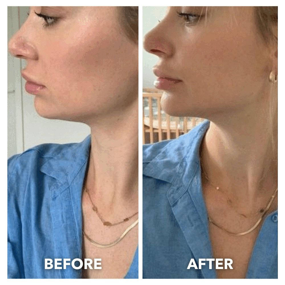 V-Lift Pro – Reusable Chin Strap for a Sculpted & Toned Jawline