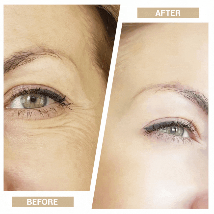 7-in-1 Facial Toning & Rejuvenation Galvanic Sculptor