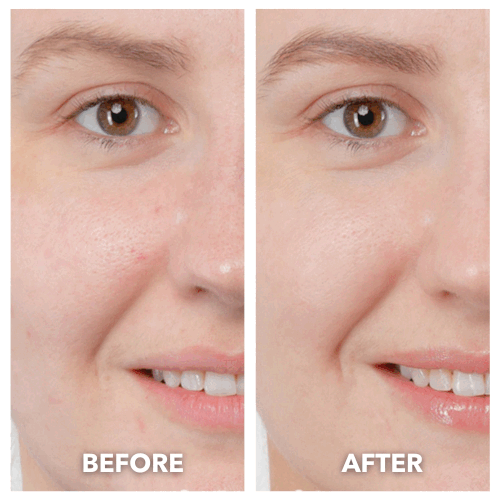 ThermaLift 5-in-1 Facial Sculptor & Cleanser Device