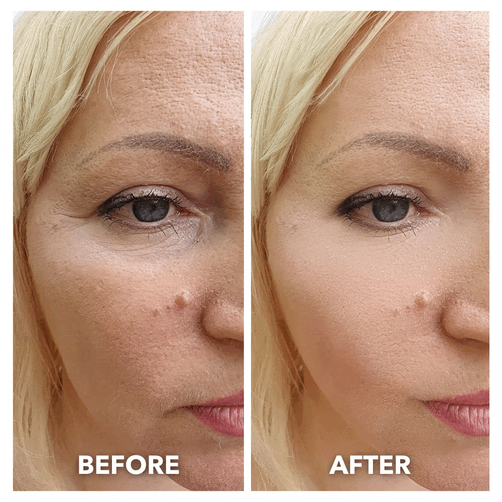 24K Gold – Firming, Hydrating & Anti-Aging Face Mask